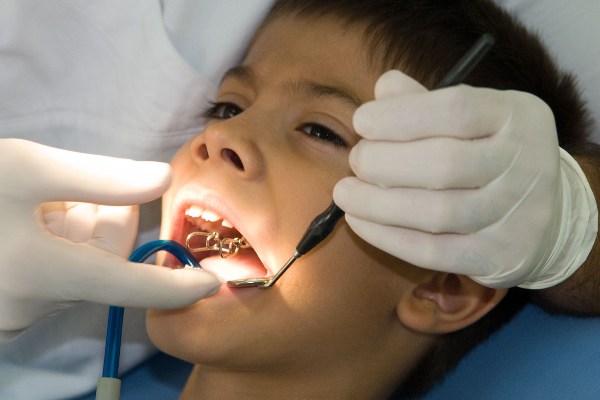 Here’s How You Can Help Your Child Fight Dental Decay in Ontario California