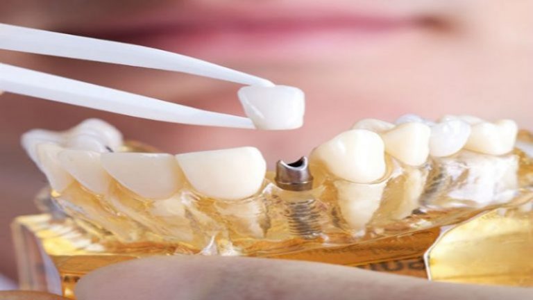 A Pediatric Dentist in Cabot, AR Keeps a Child’s Smile Healthy